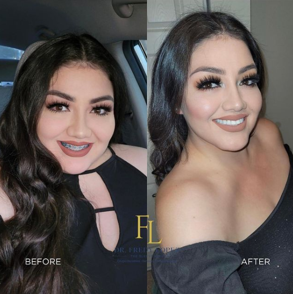 Testimonial_img
